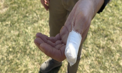 Karabük’te pitbull saldırısı: Kahraman servis şoförü müdahale etti