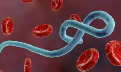 Kenya’da Ebola nedeniyle 1 kişi hayatını kaybetti: 10 kişi karantinada