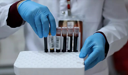 Bilim tarihinde bir ilk: "Gwada Negatif" adı verilen yeni bir kan grubu keşfedildi!