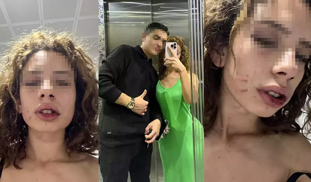 Sevgilisini bayıltana kadar dövdü, 17 yıl hapisle yargılanacak