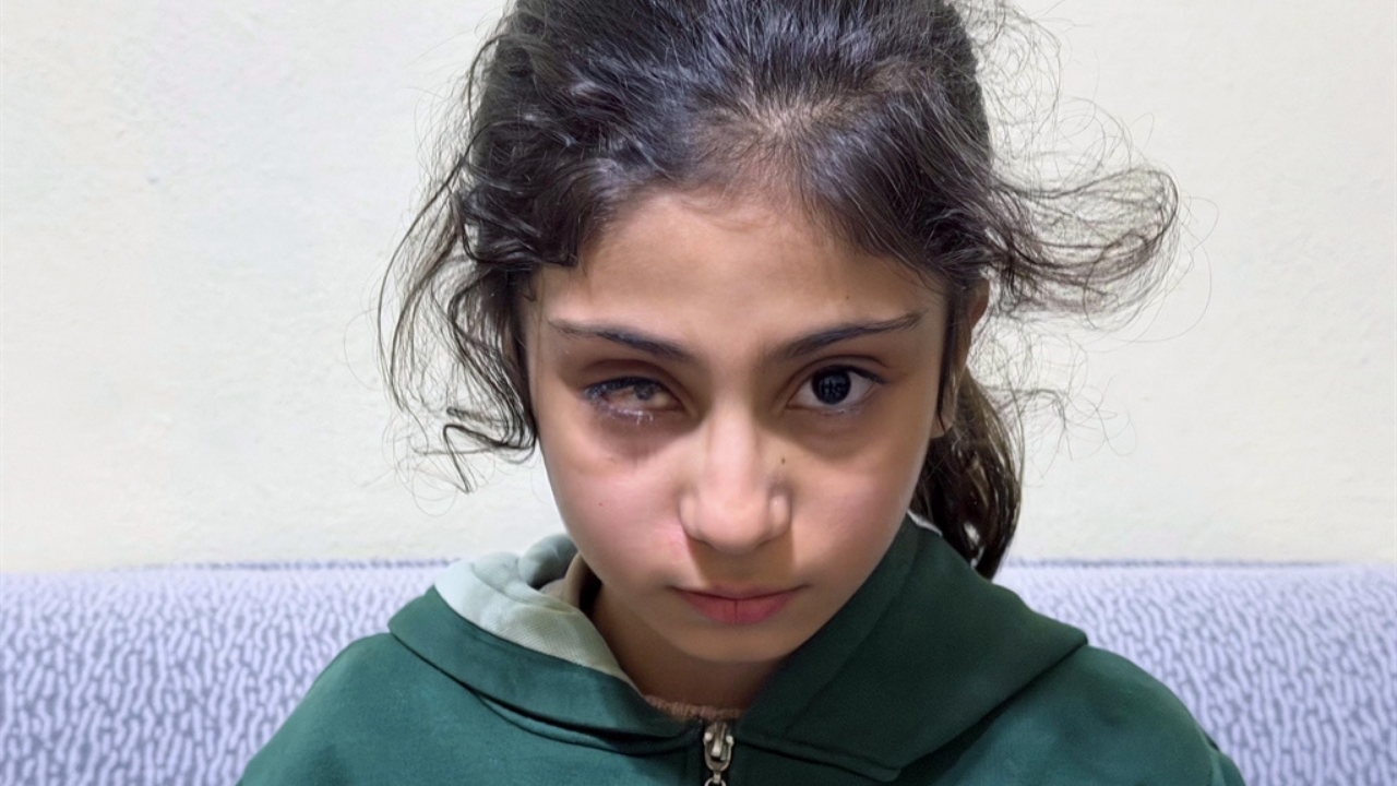 8 yaşındaki şeyma ihmal sonucu gözünü kaybetti-2