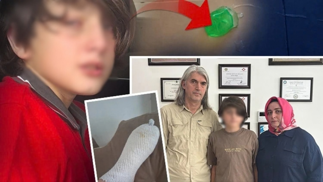 Oyuncak patladı, 11 yaşındaki çocuk hastanelik oldu: Aileden suç duyurusu